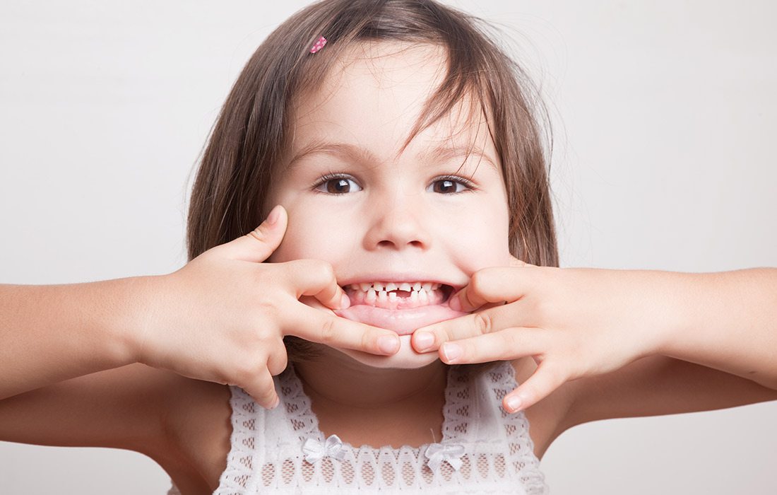 child grinning with a missing tooth